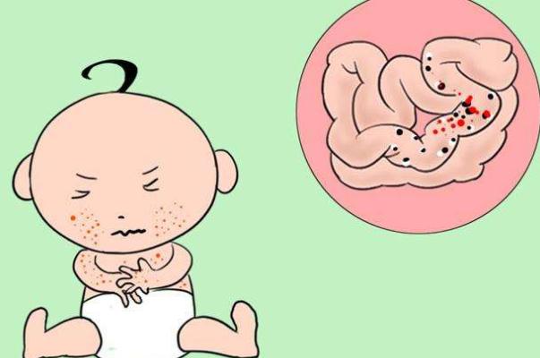 嬰兒過敏嚴(yán)重會(huì)怎么樣 嬰兒過敏嚴(yán)重有自愈可能嗎 嬰兒過敏嚴(yán)重會(huì)怎么樣 嬰兒過敏嚴(yán)重有自愈可能嗎