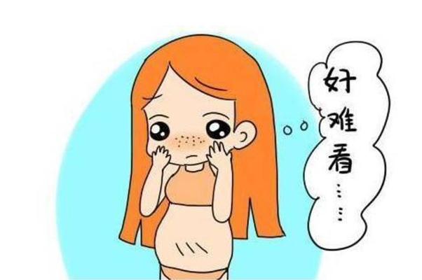 妊娠紋癢用什么止癢 妊娠紋癢怎么解決 妊娠紋癢用什么止癢 妊娠紋癢怎么解決
