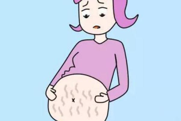 妊娠紋可以完全修復(fù)嗎 怎樣去除妊辰紋妙招 妊娠紋可以完全修復(fù)嗎 怎樣去除妊辰紋妙招