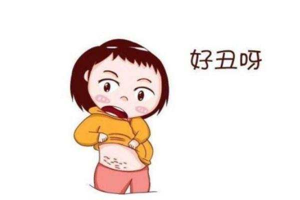 妊娠紋能修復嗎 妊娠紋能淡化嗎 妊娠紋能修復嗎 妊娠紋能淡化嗎