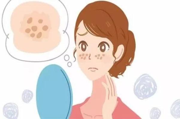 妊娠斑是怎么形成的 妊娠斑怎么調理可以淡斑 妊娠斑是怎么形成的 妊娠斑怎么調理可以淡斑