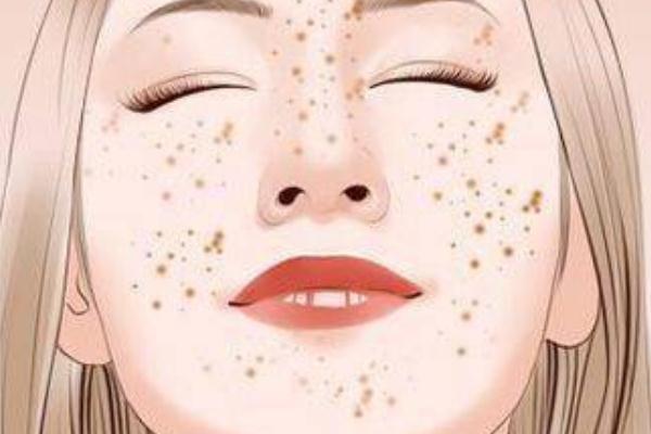 妊娠斑可以去掉嗎 妊娠斑可以用祛斑霜嗎 妊娠斑可以去掉嗎 妊娠斑可以用祛斑霜嗎