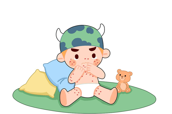 長(zhǎng)痱子有什么癥狀 長(zhǎng)痱子能根治嗎