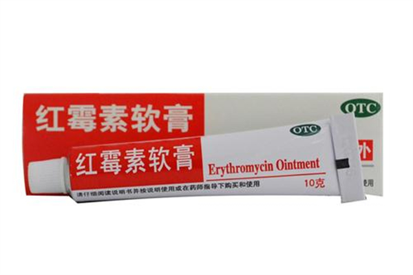 長痱子有什么癥狀 長痱子能根治嗎 長痱子有什么癥狀 長痱子能根治嗎