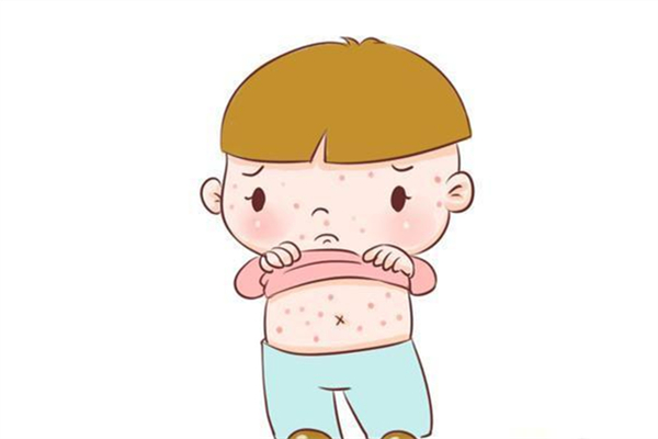 長(zhǎng)痱子怎么辦 長(zhǎng)痱子用什么藥療效比較好 長(zhǎng)痱子怎么辦 長(zhǎng)痱子用什么藥療效比較好