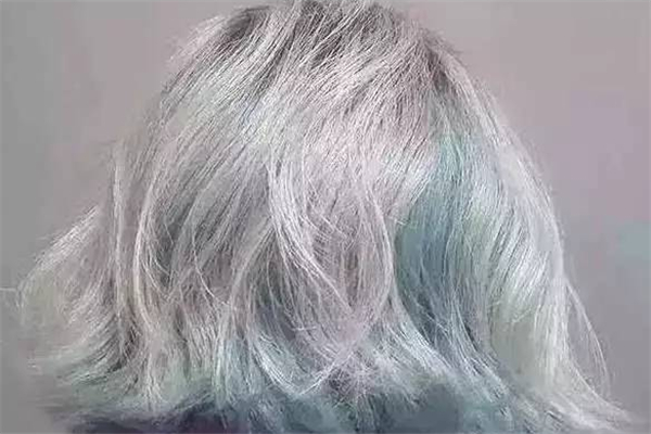 染頭發(fā)后有大塊頭皮屑怎么辦 染頭發(fā)后頭皮屑多是什么原因 染頭發(fā)后有大塊頭皮屑怎么辦 染頭發(fā)后頭皮屑多是什么原因