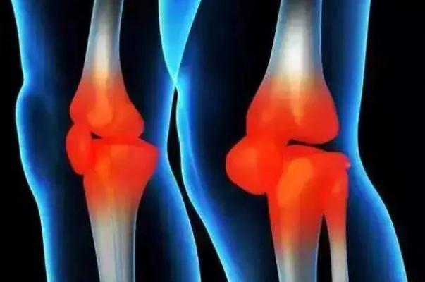 風(fēng)濕病有哪些癥狀 風(fēng)濕病怎么治最好的方法 風(fēng)濕病有哪些癥狀 風(fēng)濕病怎么治最好的方法