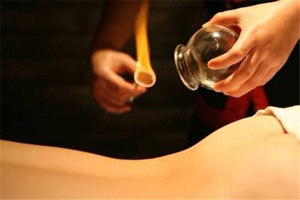 拔罐都可以吹空調(diào)嗎 拔罐后的五大注意事項(xiàng) 拔罐都可以吹空調(diào)嗎 拔罐后的五大注意事項(xiàng)