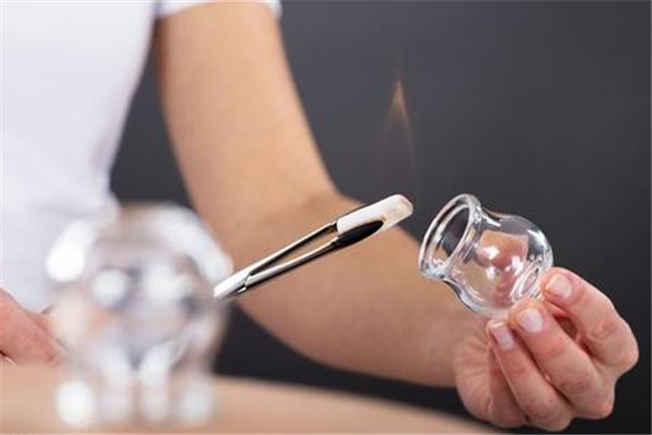 拔罐用火罐好還是氣罐好 拔火罐和氣罐的區(qū)別 拔罐用火罐好還是氣罐好 拔火罐和氣罐的區(qū)別