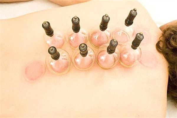 拔罐用火罐好還是氣罐好 拔火罐和氣罐的區(qū)別 拔罐用火罐好還是氣罐好 拔火罐和氣罐的區(qū)別