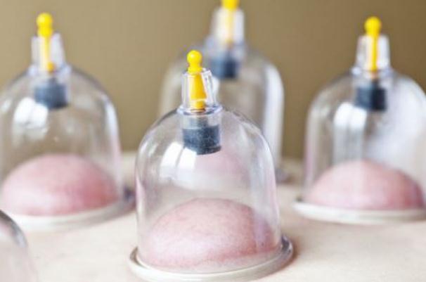 拔火罐會出血嗎 拔火罐會拔出水嗎 拔火罐會出血嗎 拔火罐會拔出水嗎