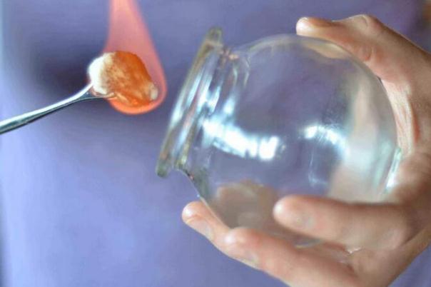 拔火罐能吹空調嗎 拔火罐能吹風嗎 拔火罐能吹空調嗎 拔火罐能吹風嗎