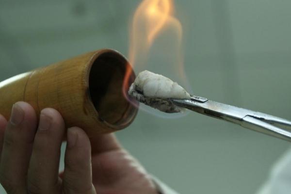 拔火罐的印子多久消除 拔火罐的頻率多久一次 拔火罐的印子多久消除 拔火罐的頻率多久一次