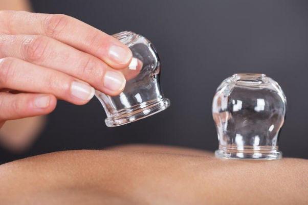 拔火罐會出血嗎 拔火罐會拔出水嗎 拔火罐會出血嗎 拔火罐會拔出水嗎