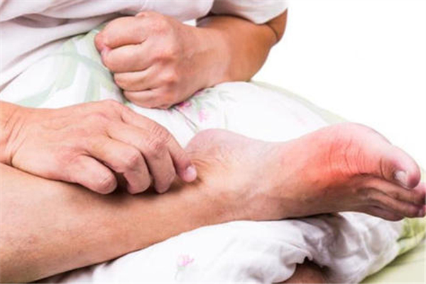 尿酸高會引起什么疾病 尿酸高的危害 尿酸高會引起什么疾病 尿酸高的危害