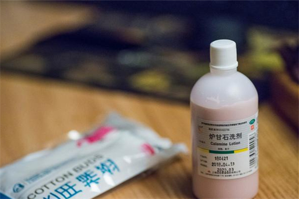 爐甘石洗劑可以祛熱痱子嗎 爐甘石洗劑的作用和功效 爐甘石洗劑可以祛熱痱子嗎 爐甘石洗劑的作用和功效