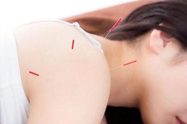 針灸會導(dǎo)致神經(jīng)受損嗎 針灸會出血嗎 針灸會導(dǎo)致神經(jīng)受損嗎 針灸會出血嗎