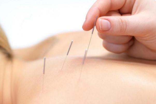 針灸對(duì)腰椎間盤突出有用嗎 針灸對(duì)頸椎病有效果嗎 針灸對(duì)腰椎間盤突出有用嗎 針灸對(duì)頸椎病有效果嗎