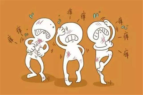 蕁麻疹會(huì)引起頭皮癢嗎 蕁麻疹有什么表現(xiàn)癥狀 蕁麻疹會(huì)引起頭皮癢嗎 蕁麻疹有什么表現(xiàn)癥狀