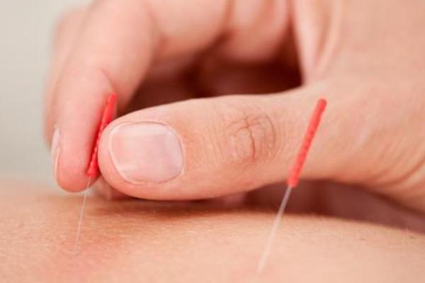 針灸對(duì)腰椎間盤突出有用嗎 針灸對(duì)頸椎病有效果嗎 針灸對(duì)腰椎間盤突出有用嗎 針灸對(duì)頸椎病有效果嗎