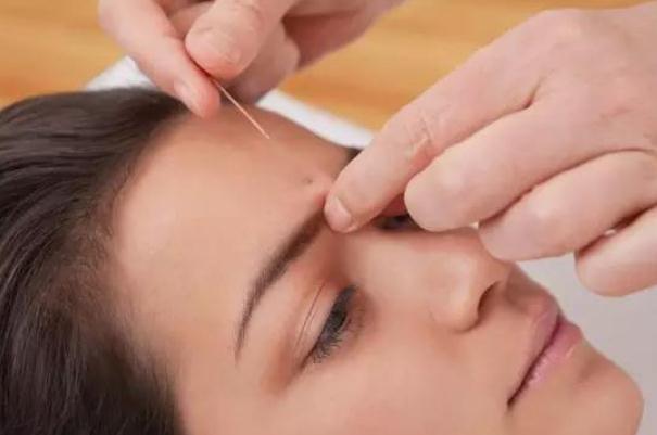 針灸會影響月經(jīng)推遲嗎 針灸會導(dǎo)致月經(jīng)不調(diào)嗎 針灸會影響月經(jīng)推遲嗎 針灸會導(dǎo)致月經(jīng)不調(diào)嗎