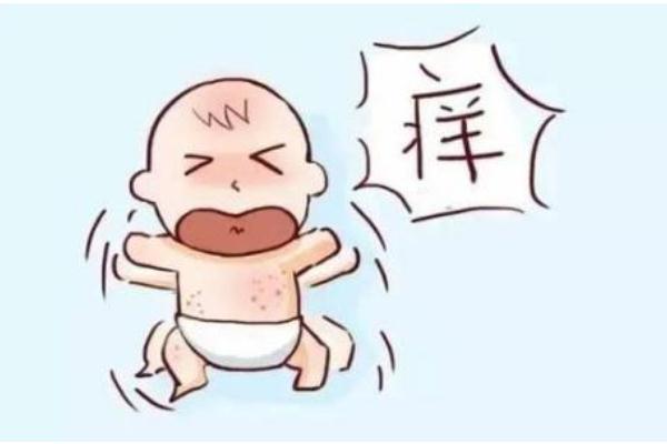 寶寶濕疹會(huì)傳染嗎 寶寶濕疹會(huì)自己消失嗎 寶寶濕疹會(huì)傳染嗎 寶寶濕疹會(huì)自己消失嗎