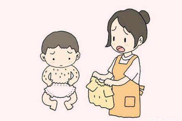 寶寶濕疹會(huì)傳染嗎 寶寶濕疹會(huì)自己消失嗎 寶寶濕疹會(huì)傳染嗎 寶寶濕疹會(huì)自己消失嗎