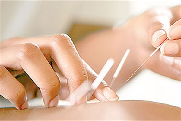 埋線減肥是怎么做的 埋線減肥靠譜嗎 埋線減肥是怎么做的 埋線減肥靠譜嗎