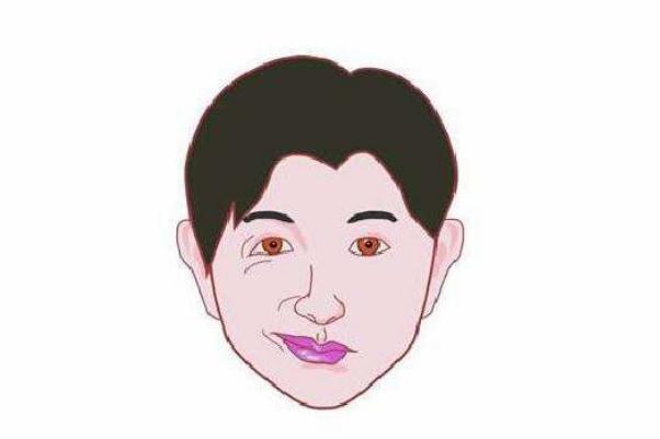 面癱有家族遺傳性嗎 面癱有偏方嗎 面癱有家族遺傳性嗎 面癱有偏方嗎