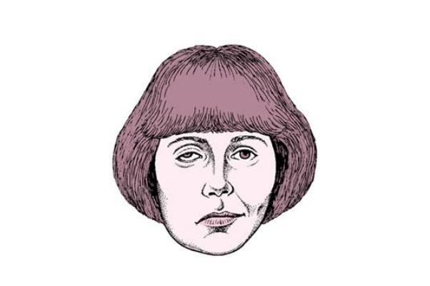 面癱有什么后遺癥 面癱有什么特效藥 面癱有什么后遺癥 面癱有什么特效藥