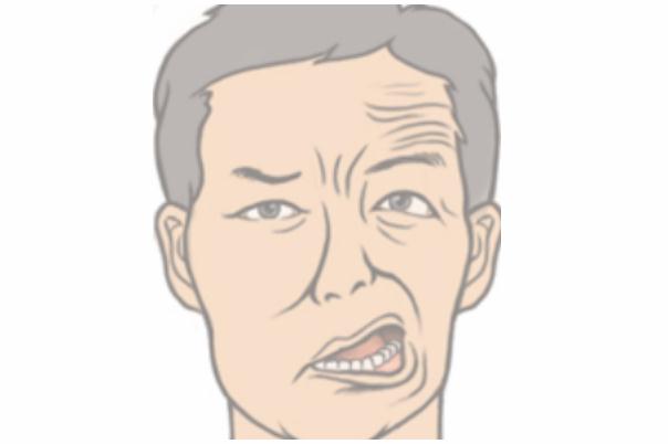 面癱有家族遺傳性嗎 面癱有偏方嗎 面癱有家族遺傳性嗎 面癱有偏方嗎