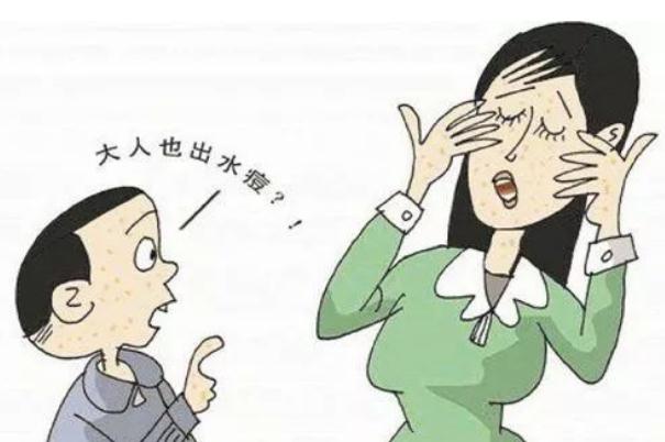 水痘要打點(diǎn)滴嗎 水痘要吃藥嗎 水痘要打點(diǎn)滴嗎 水痘要吃藥嗎