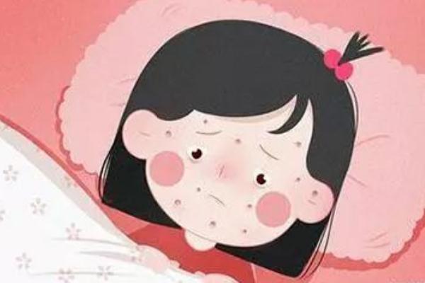 水痘有疫苗嗎 水痘有生命危險(xiǎn)嗎 水痘有疫苗嗎 水痘有生命危險(xiǎn)嗎