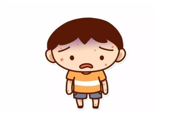 水痘要打點(diǎn)滴嗎 水痘要吃藥嗎 水痘要打點(diǎn)滴嗎 水痘要吃藥嗎