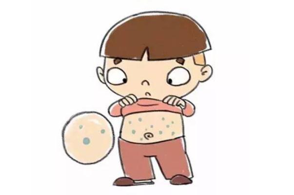 水痘的潛伏期會(huì)傳染嗎 水痘的傳播途徑 水痘的潛伏期會(huì)傳染嗎 水痘的傳播途徑