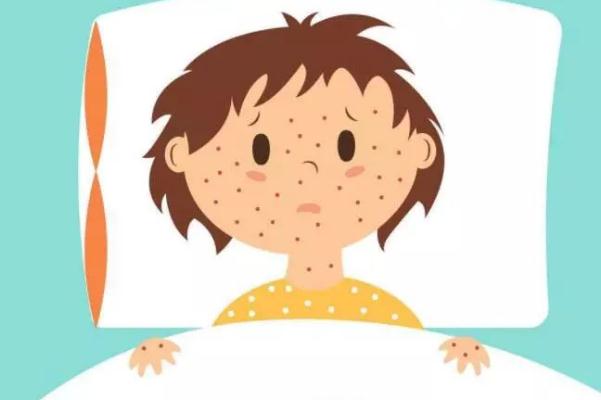 水痘一般第幾天停止長(zhǎng) 水痘一般多久可以痊愈 水痘一般第幾天停止長(zhǎng) 水痘一般多久可以痊愈