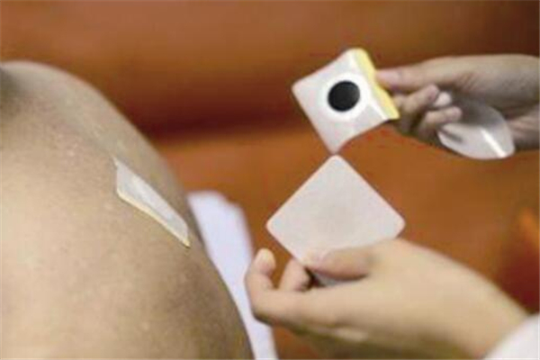 三伏貼貼多久 三伏貼貼時間長起泡了怎么辦 三伏貼貼多久 三伏貼貼時間長起泡了怎么辦