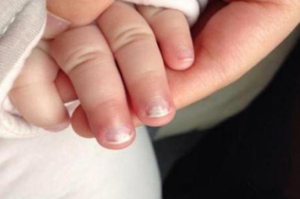 寶寶缺鋅吃什么水果好 寶寶缺鋅吃什么藥 寶寶缺鋅吃什么水果好 寶寶缺鋅吃什么藥