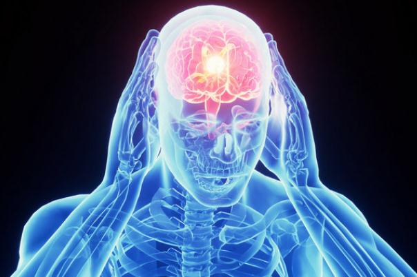 偏頭痛要忌口嗎 偏頭痛要去醫(yī)院?jiǎn)? alt=