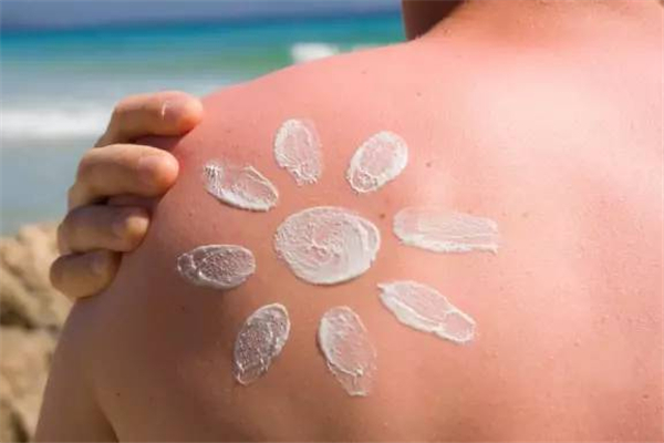 皮膚曬褪皮怎么辦 皮膚曬過之后怎處理 皮膚曬褪皮怎么辦 皮膚曬過之后怎處理