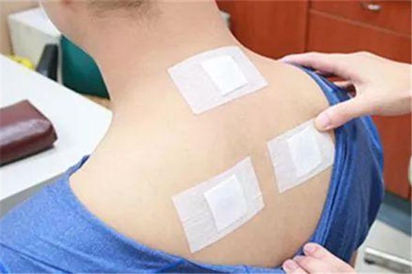 冬病夏治三伏貼的原理 冬病夏治三伏貼貼哪里 冬病夏治三伏貼的原理 冬病夏治三伏貼貼哪里