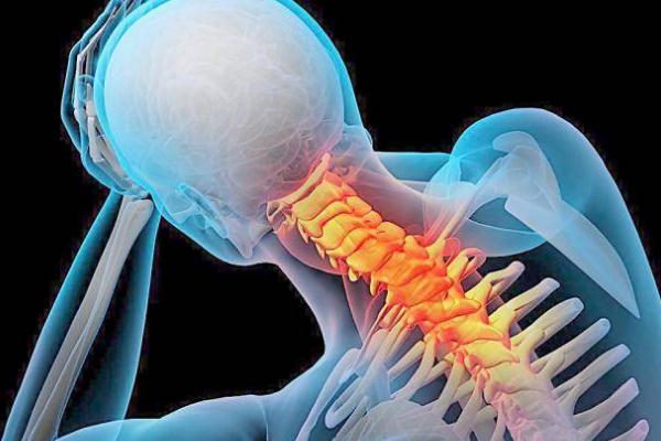 頸椎病是大病嗎 頸椎病是遺傳病嗎 頸椎病是大病嗎 頸椎病是遺傳病嗎