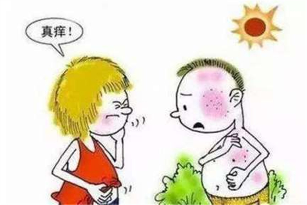 曬傷的表現(xiàn) 曬傷有什么好辦法補救 曬傷的表現(xiàn) 曬傷有什么好辦法補救