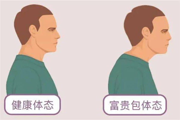 富貴包會引起頭痛嗎 富貴包會引起哪些癥狀 富貴包會引起頭痛嗎 富貴包會引起哪些癥狀