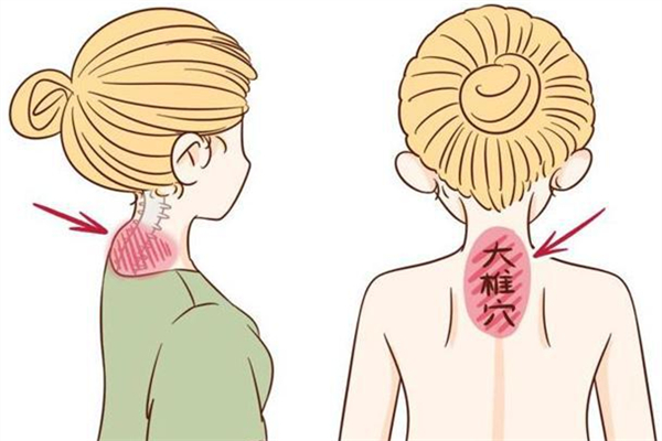 富貴包會引起頭痛嗎 富貴包會引起哪些癥狀 富貴包會引起頭痛嗎 富貴包會引起哪些癥狀