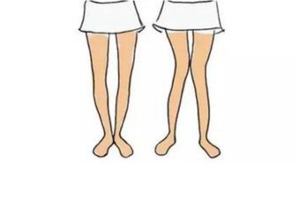 佝僂病的病因主要是 佝僂病的預防措施 佝僂病的病因主要是 佝僂病的預防措施