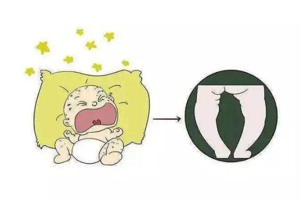 佝僂病多久可治愈 佝僂病最佳恢復(fù)期 佝僂病多久可治愈 佝僂病最佳恢復(fù)期