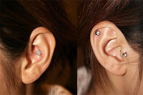 打耳洞發(fā)炎流膿怎么辦 打耳洞發(fā)炎用什么藥 打耳洞發(fā)炎流膿怎么辦 打耳洞發(fā)炎用什么藥