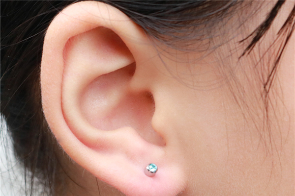 打耳洞后耳朵里長了個疙瘩 打耳洞后耳朵里有硬塊 打耳洞后耳朵里長了個疙瘩 打耳洞后耳朵里有硬塊