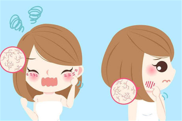 皮膚干燥的原因是什么 皮膚干燥會(huì)引起什么皮膚問題 皮膚干燥的原因是什么 皮膚干燥會(huì)引起什么皮膚問題